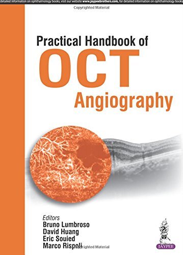 Practical Handbook of OCT Angiography