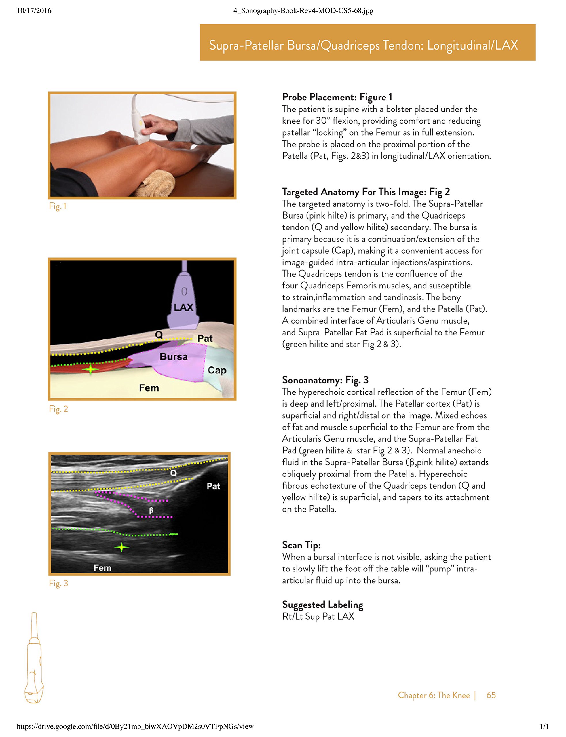 Lev Protocol Songraph Sonography of the Extremities Techniques and Protocols by Randy E ...