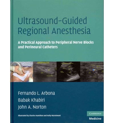 Ultrasound-Guided Regional Anesthesia