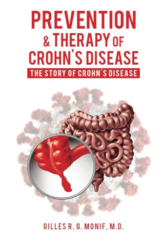 Prevention & Therapy Of Crohn's Disease: The Story Of Crohn's Disease