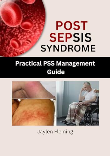 POST SEPSIS SYNDROME: Practical PSS Management Guide by Jaylen Fleming ...