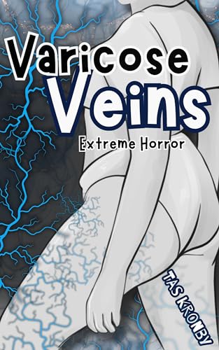 Varicose Veins