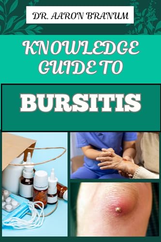 KNOWLEDGE GUIDE TO BURSITIS: Essential Guide To Symptoms, Causes ...