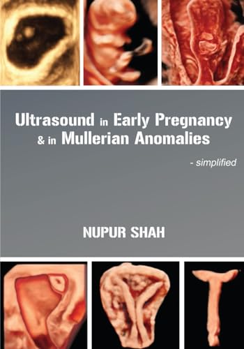 Ultrasound in Early Pregnancy & in Mullerian Anomalies - Simplified