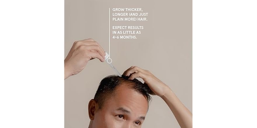 Keeps Extra Strength Minoxidil for Men Topical Hair Growth Serum