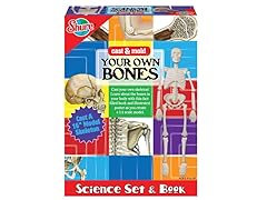 Cast and Mold Your Own Bones