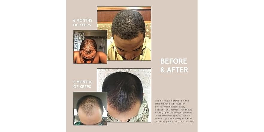 Picture of Keeps Extra Strength Minoxidil for Men Topical Hair Growth Serum