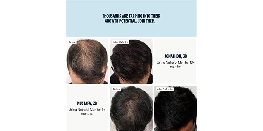 thumbnail image 2 of Nutrafol Men's Hair Growth Supplement - Pack Of 2 Glass Bottles (240 Total Capsules) 2 of 6