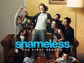 shameless amazon prime españa