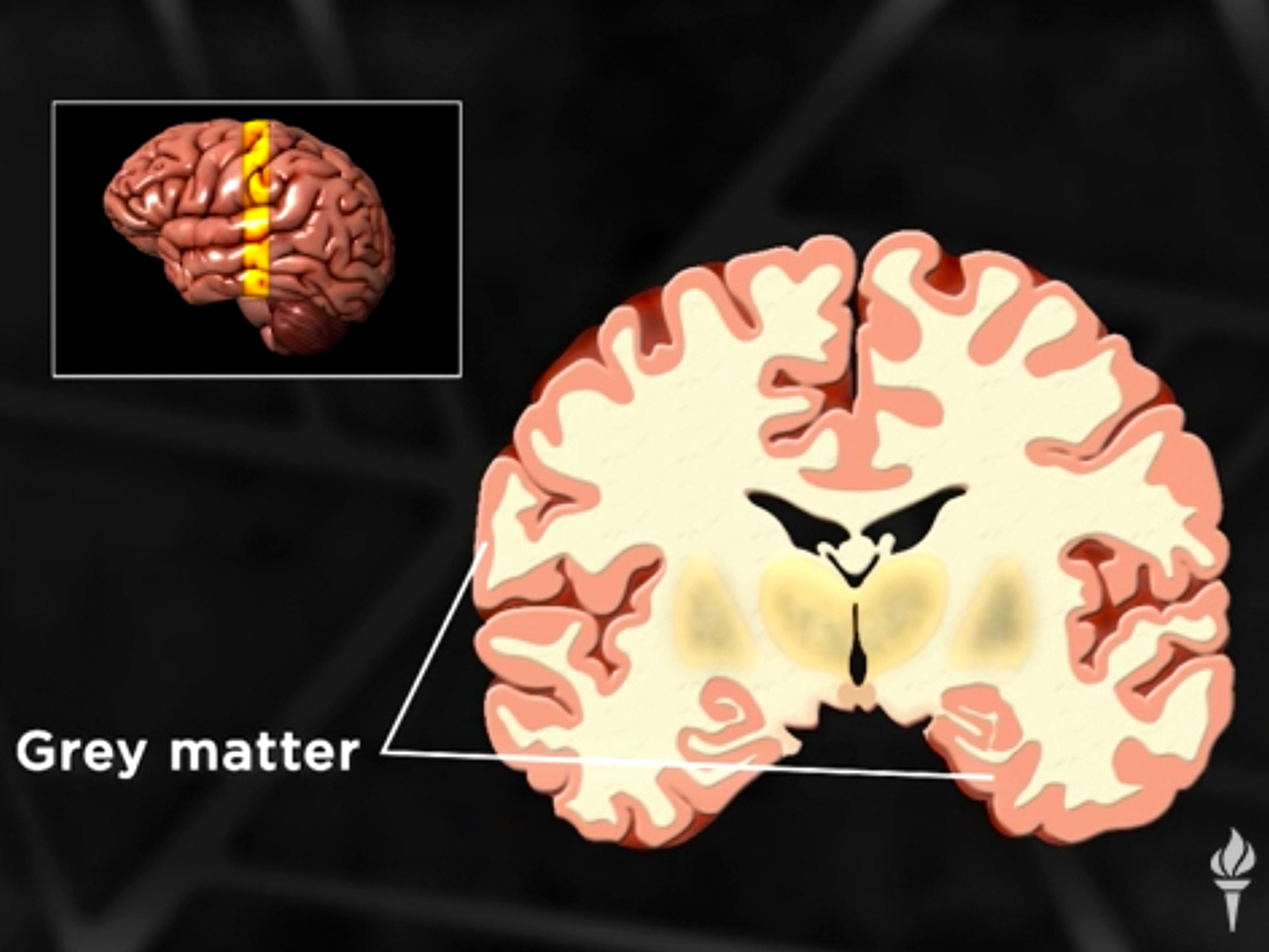 Prime Video: Brain Myths Exploded: Lessons from Neuroscience